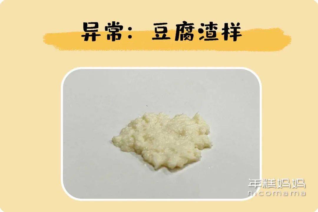 分泌物像豆腐渣是怎么回事