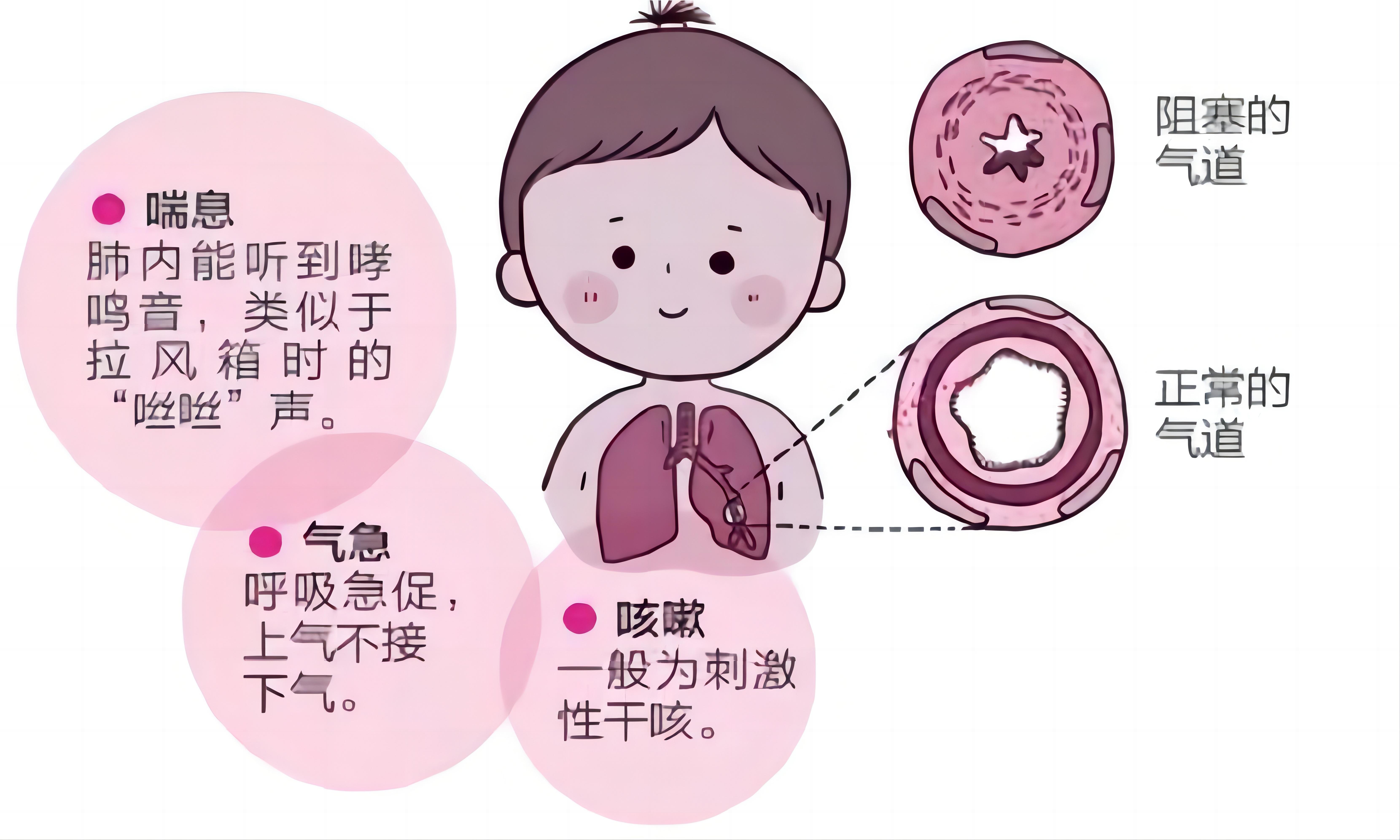 麴家馨
