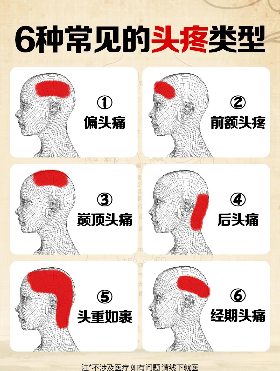偏头痛的症状有哪些