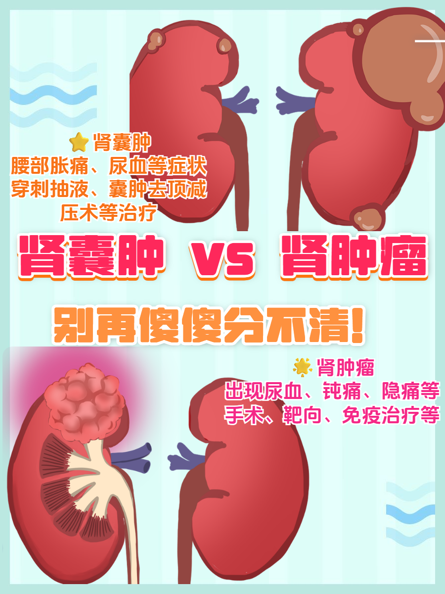 肾脏囊肿是怎么引起的