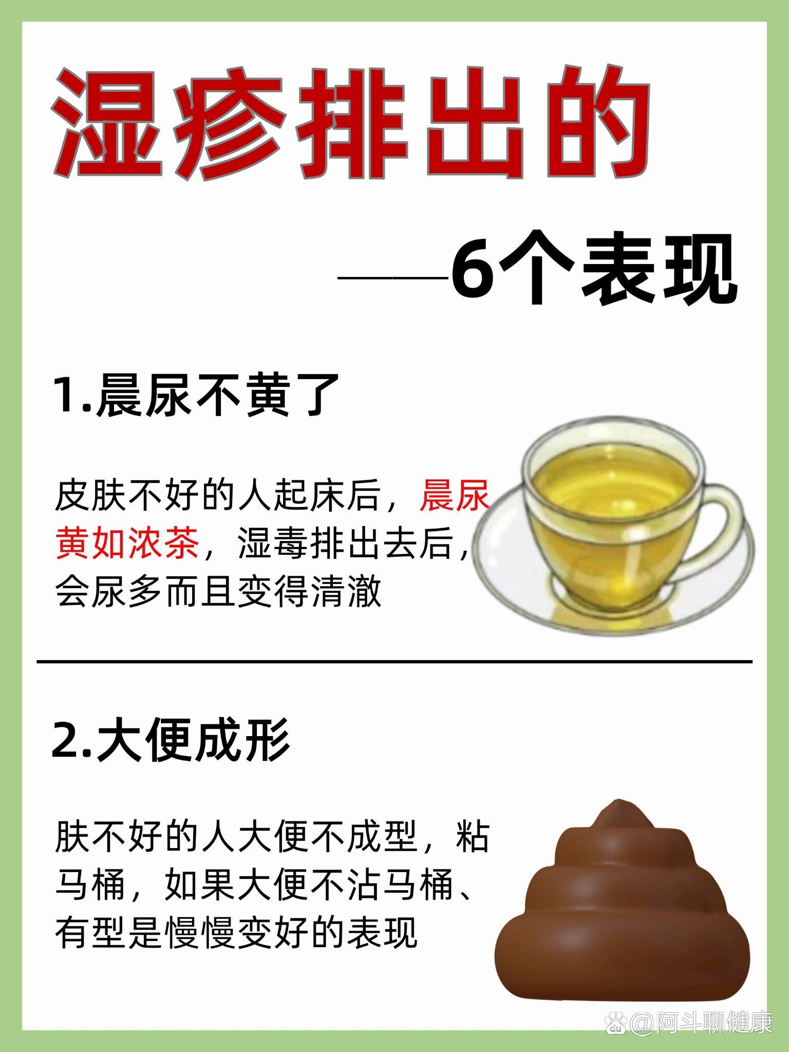 湿疹要注意什么?
