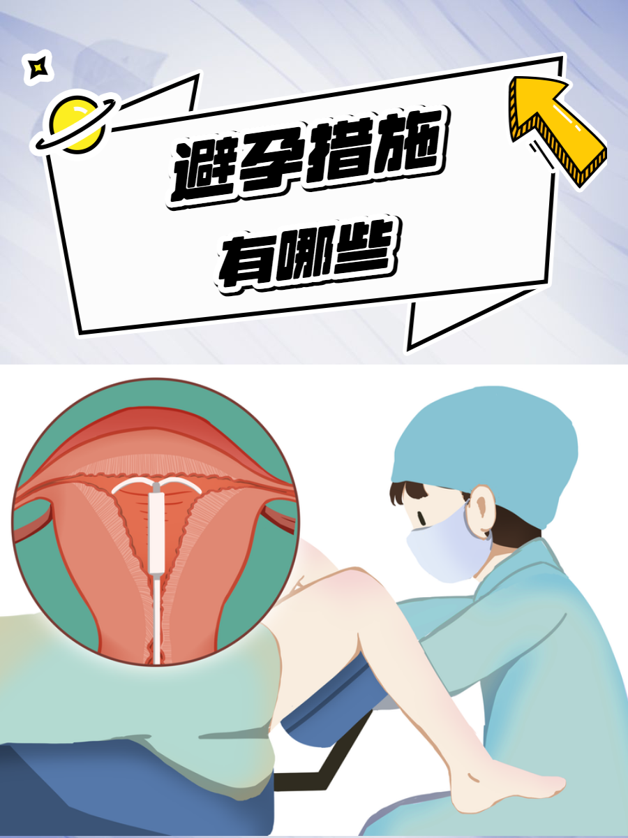 最好的避孕方法