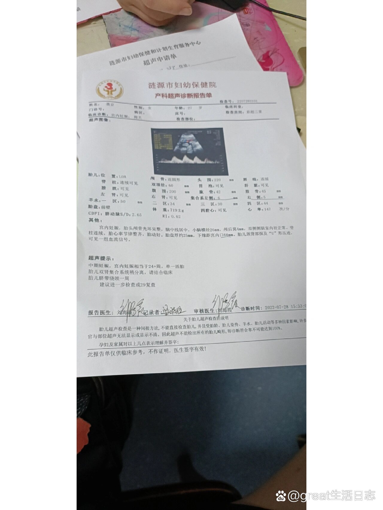 胎儿肾盂分离一定是男孩吗