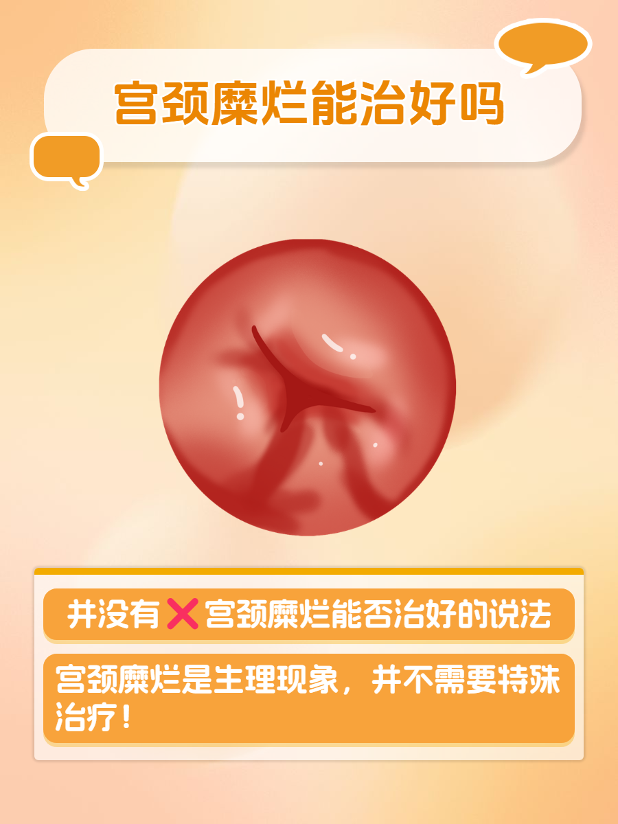 重度宫颈糜烂的治疗方法