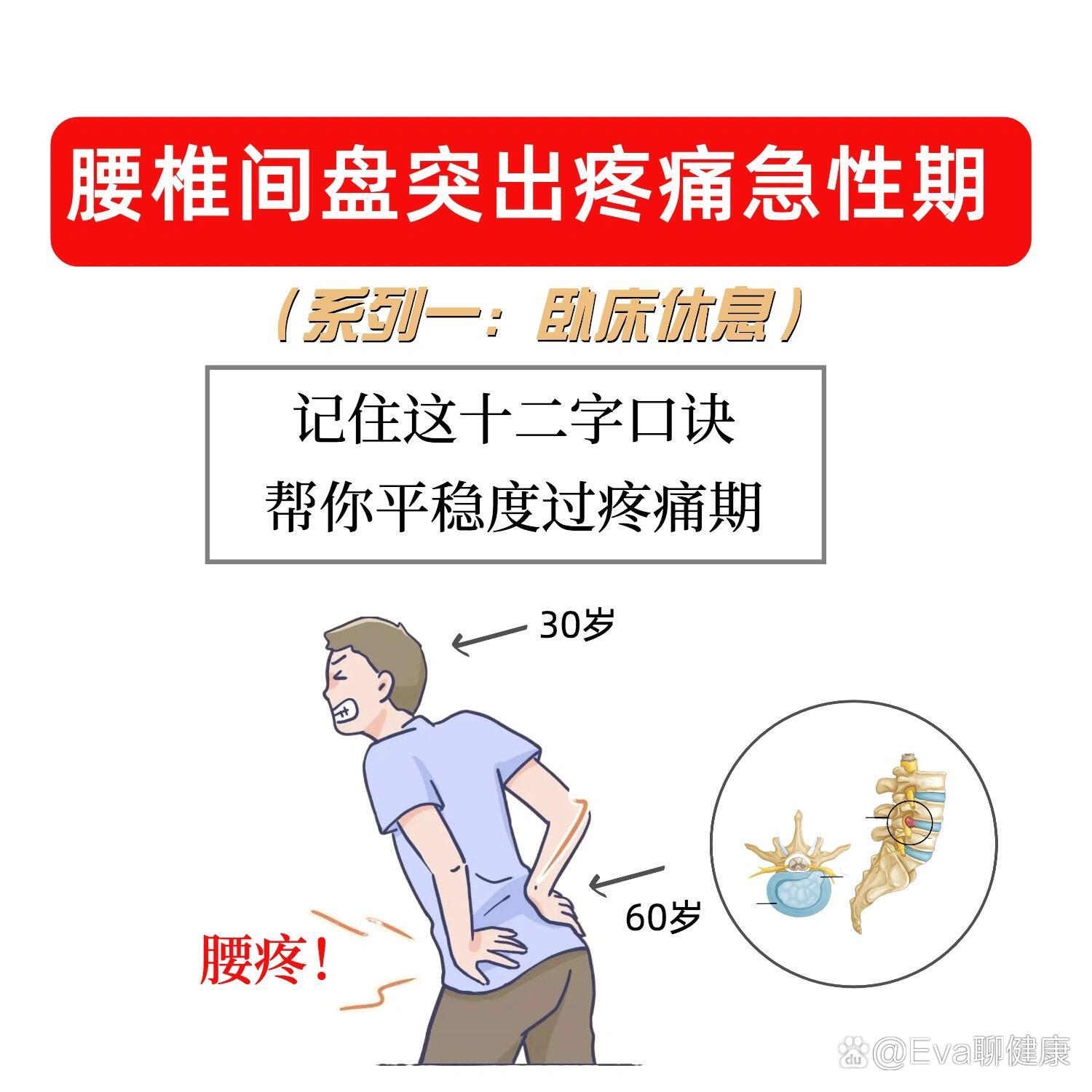 腰椎间盘突出怎么治疗最好