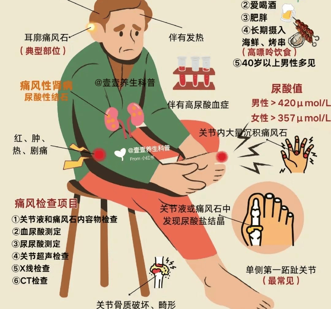 引发痛风的原因