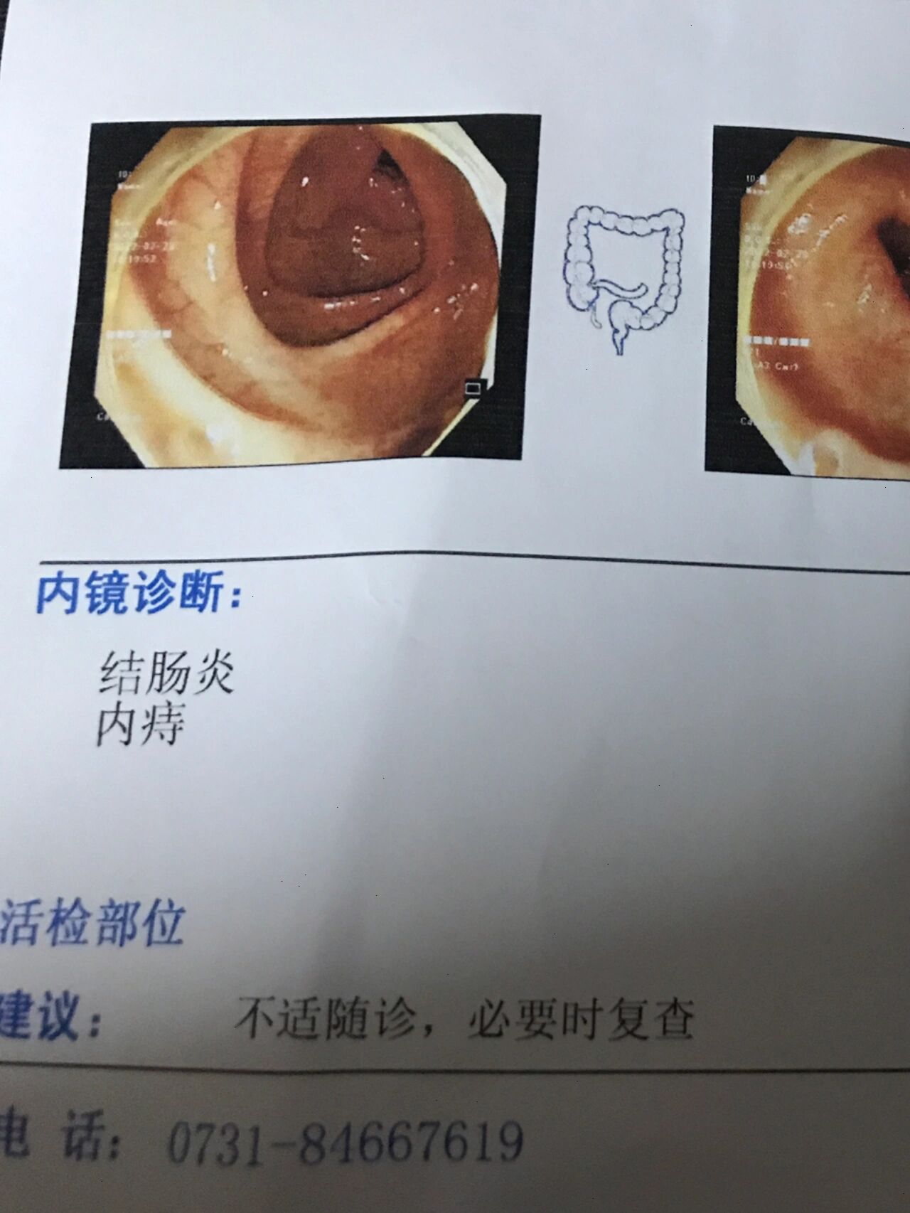 鄂灿