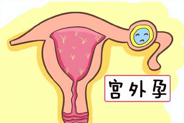 蒲灵安