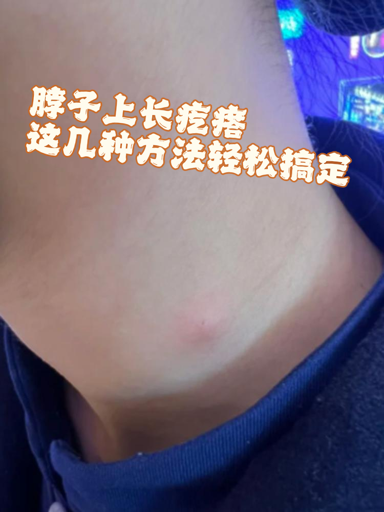 脖子左侧里面有个疙瘩