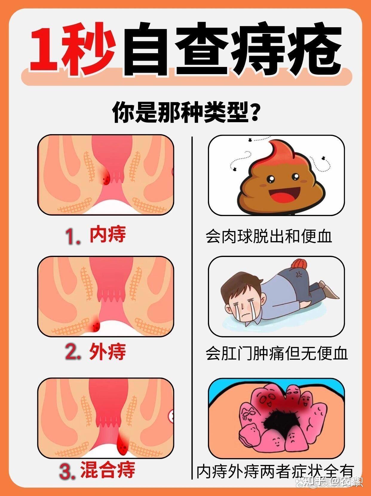 今天上厕所时发现肛门菊花上长了和柔软的小