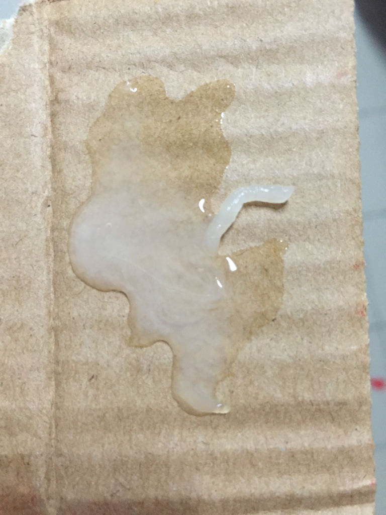 精液液化后的样子正常吗