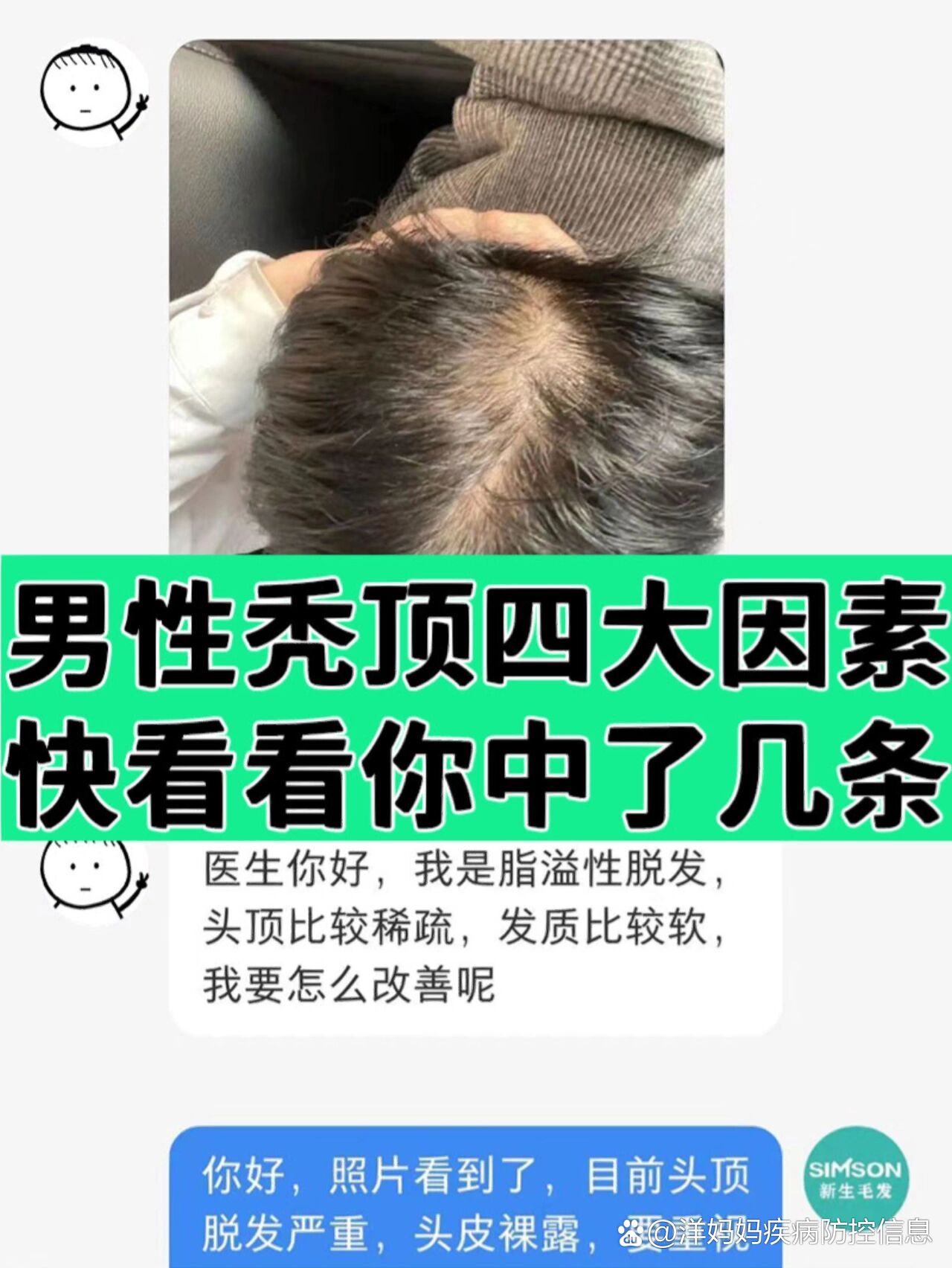 男性脱发的原因有什么?