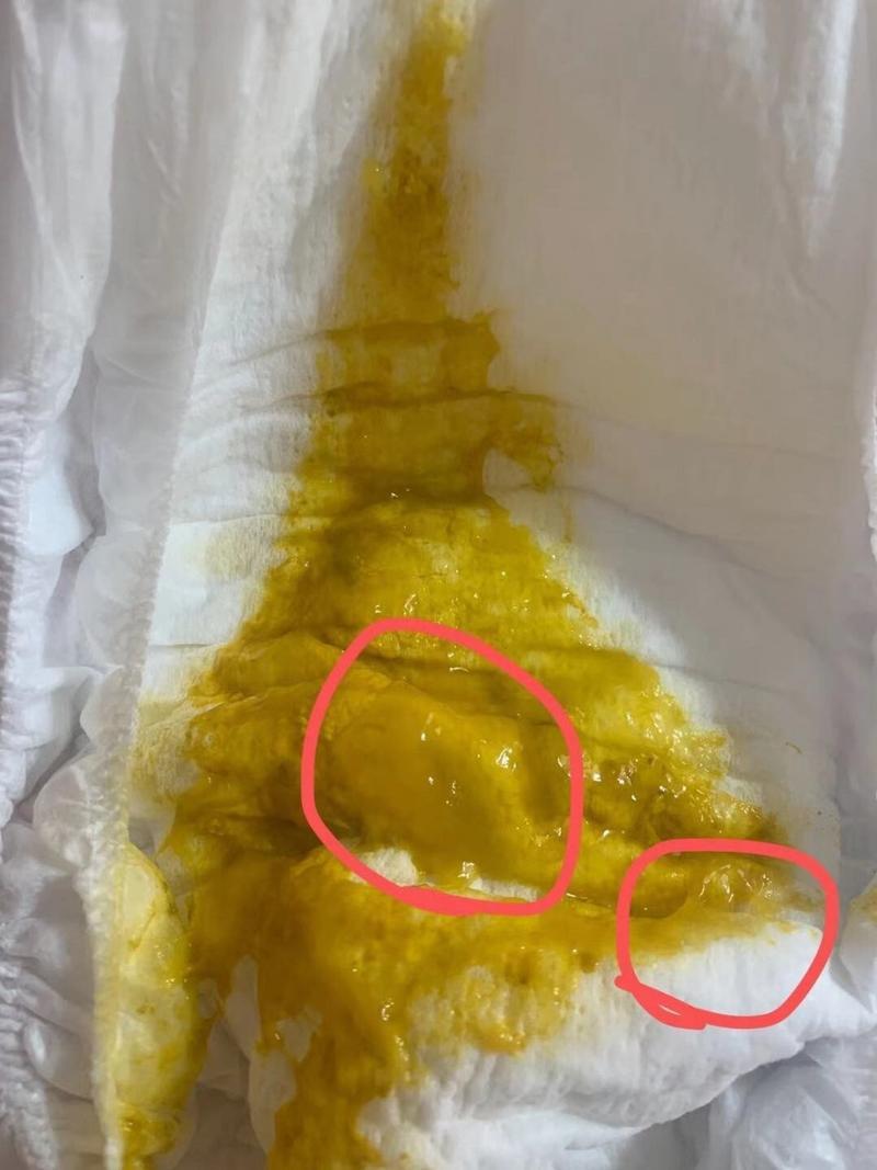 是什么病?