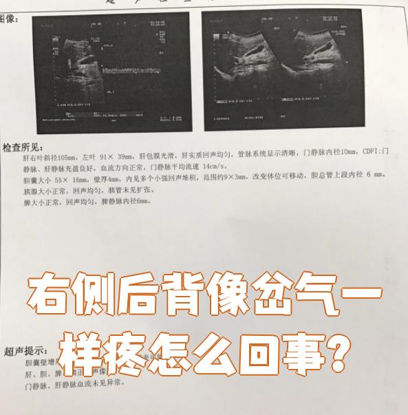 突然后背痛像岔气一样是怎么了