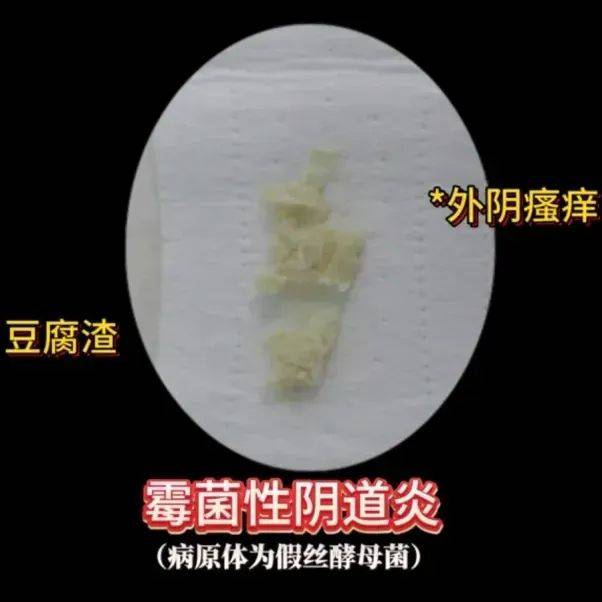 施采珊