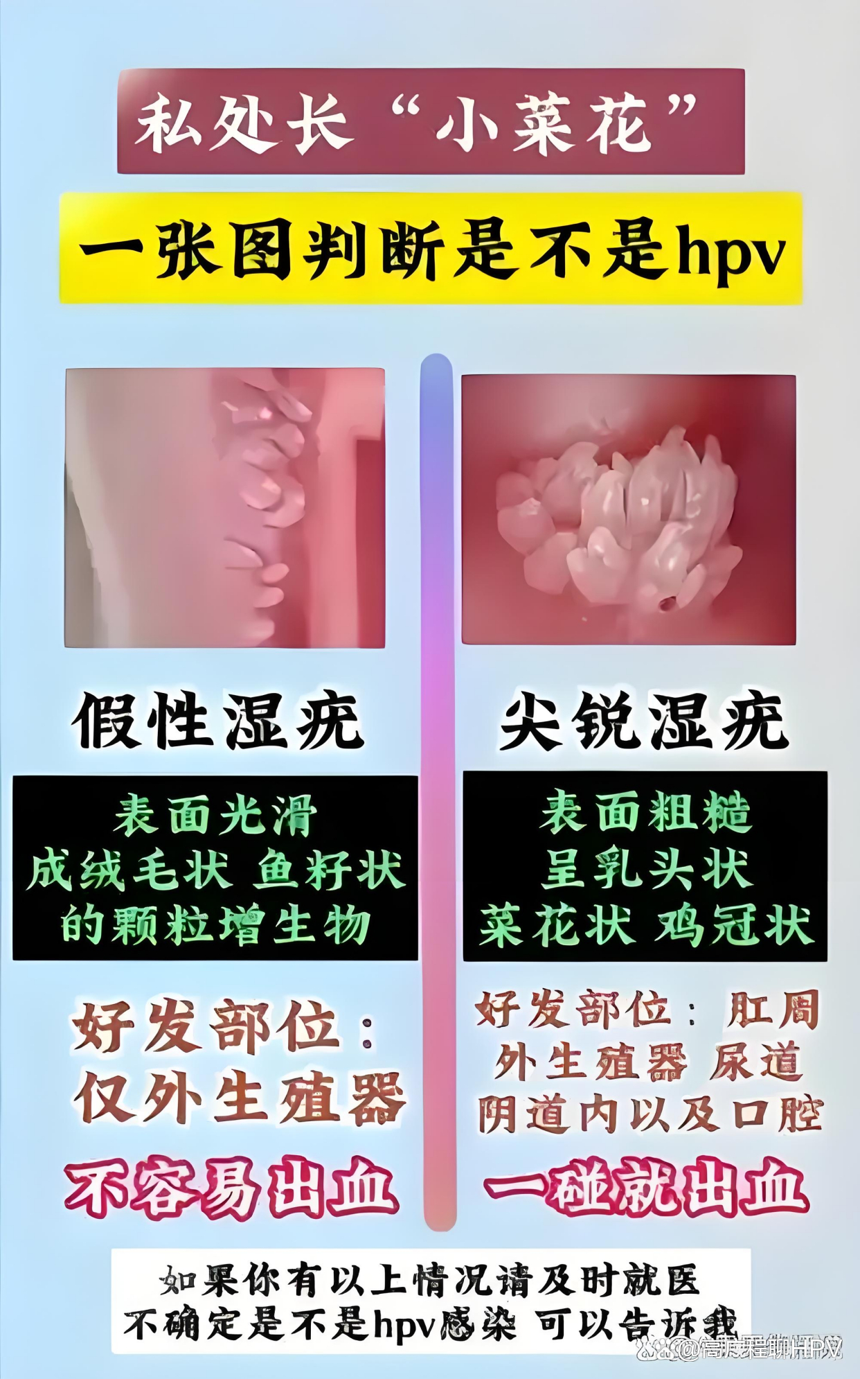 一般女性尖锐湿疣有什么症状?