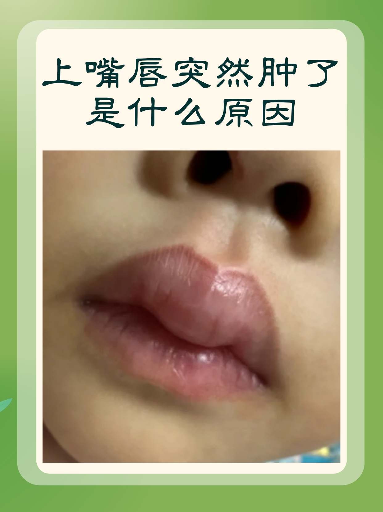 嘴唇发麻是什么原因
