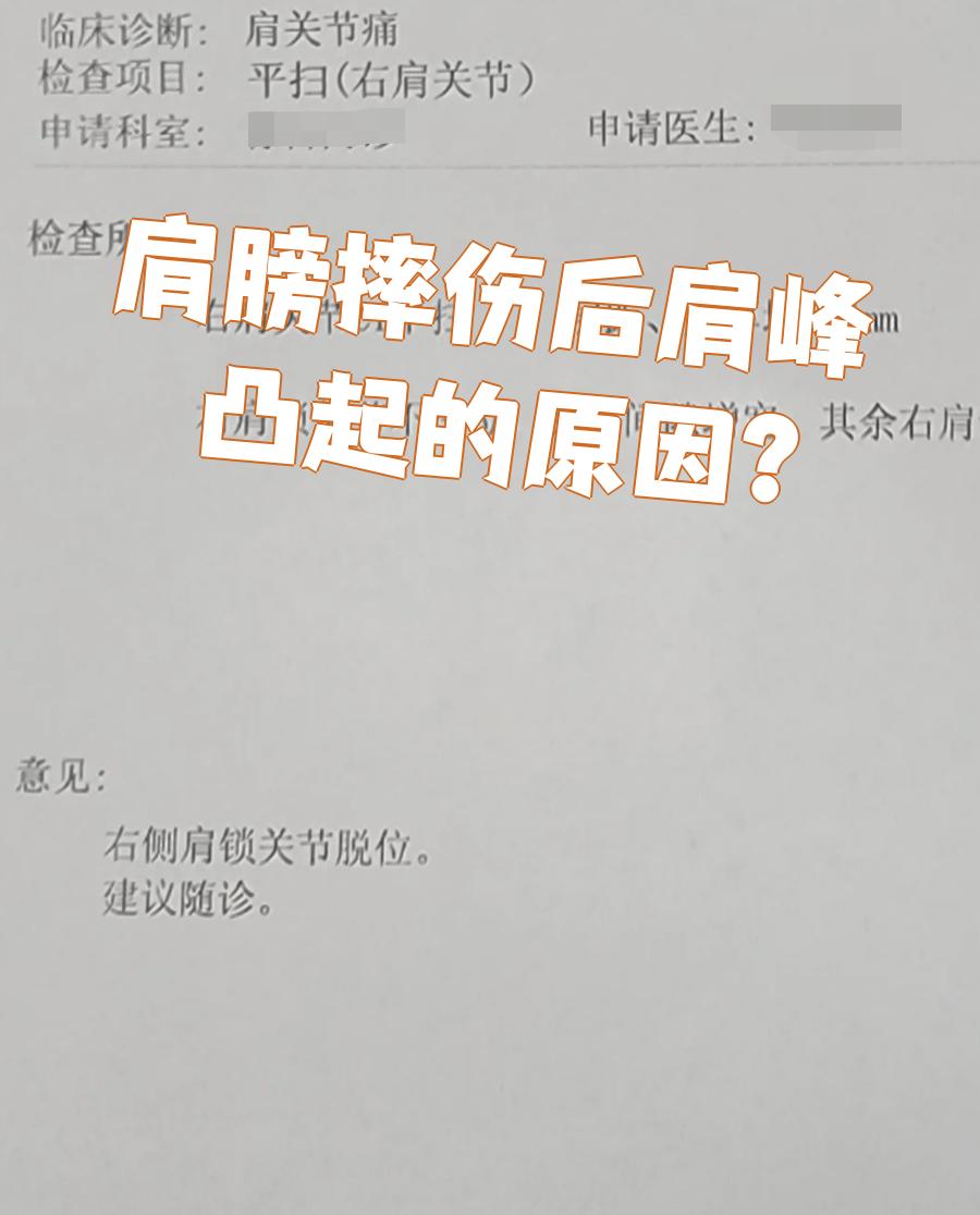 左肩膀上骨头突出