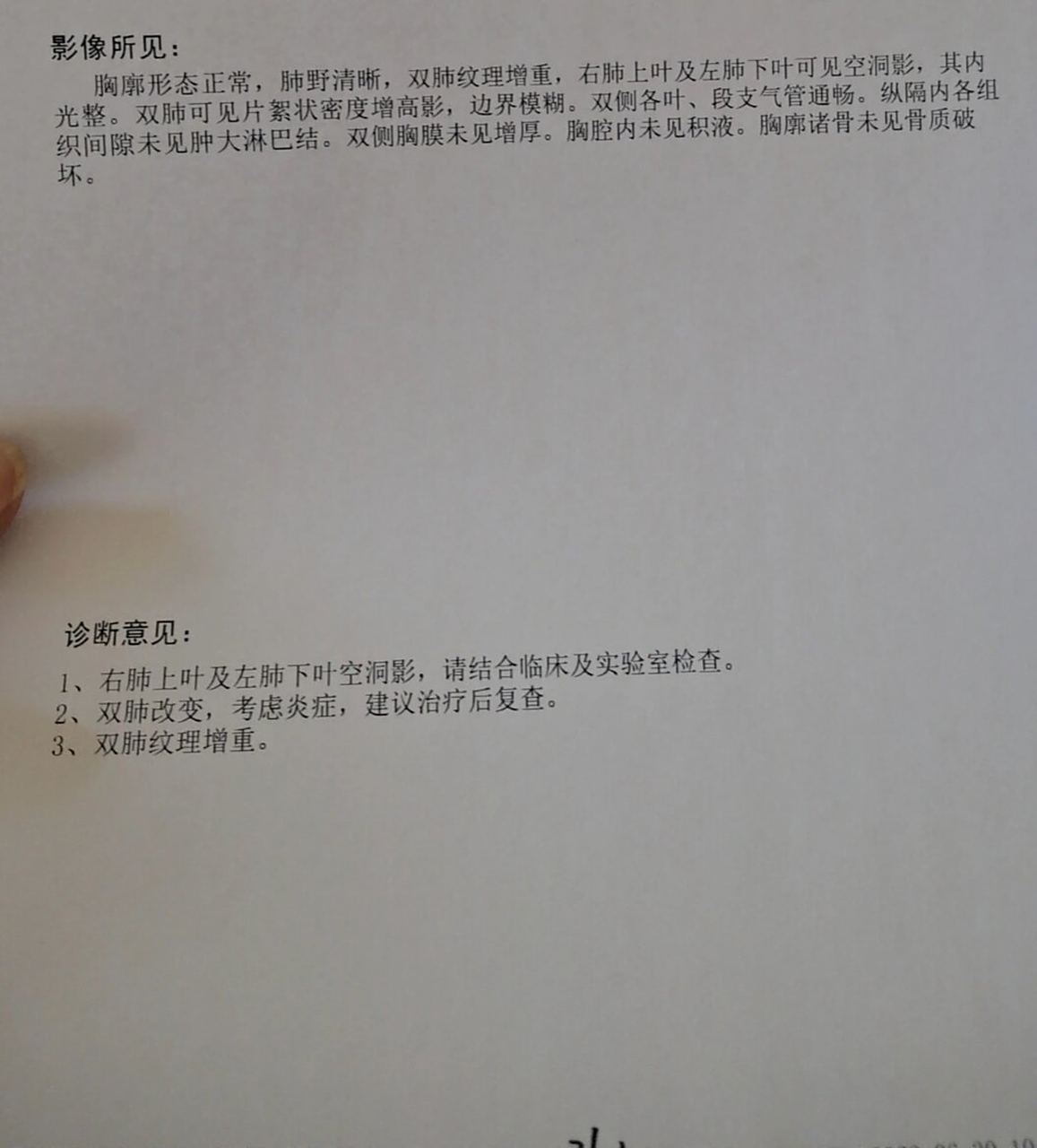 肺结核潜伏期能检查出来吗