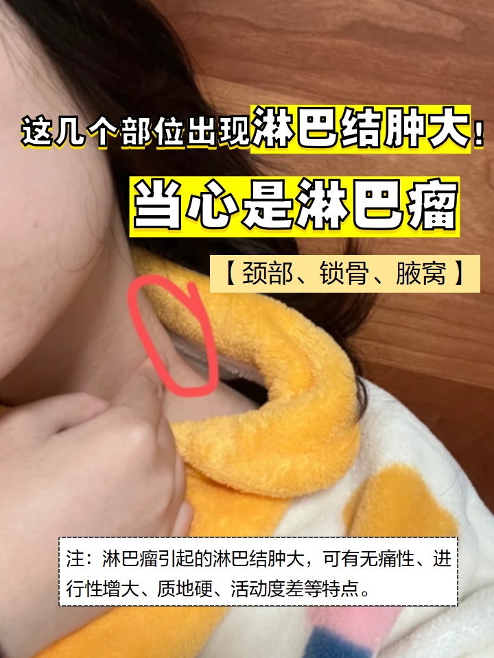 淋巴结肿大的原因