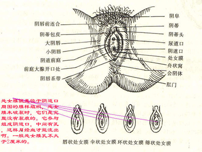 处女膜长什么样