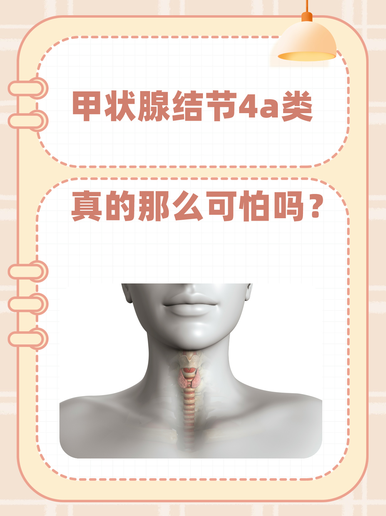 甲状腺ca什么意思