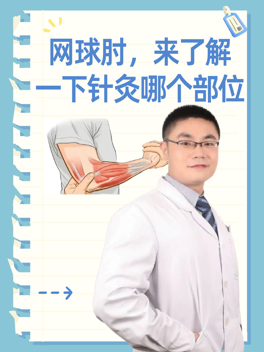网球肘可以自愈吗