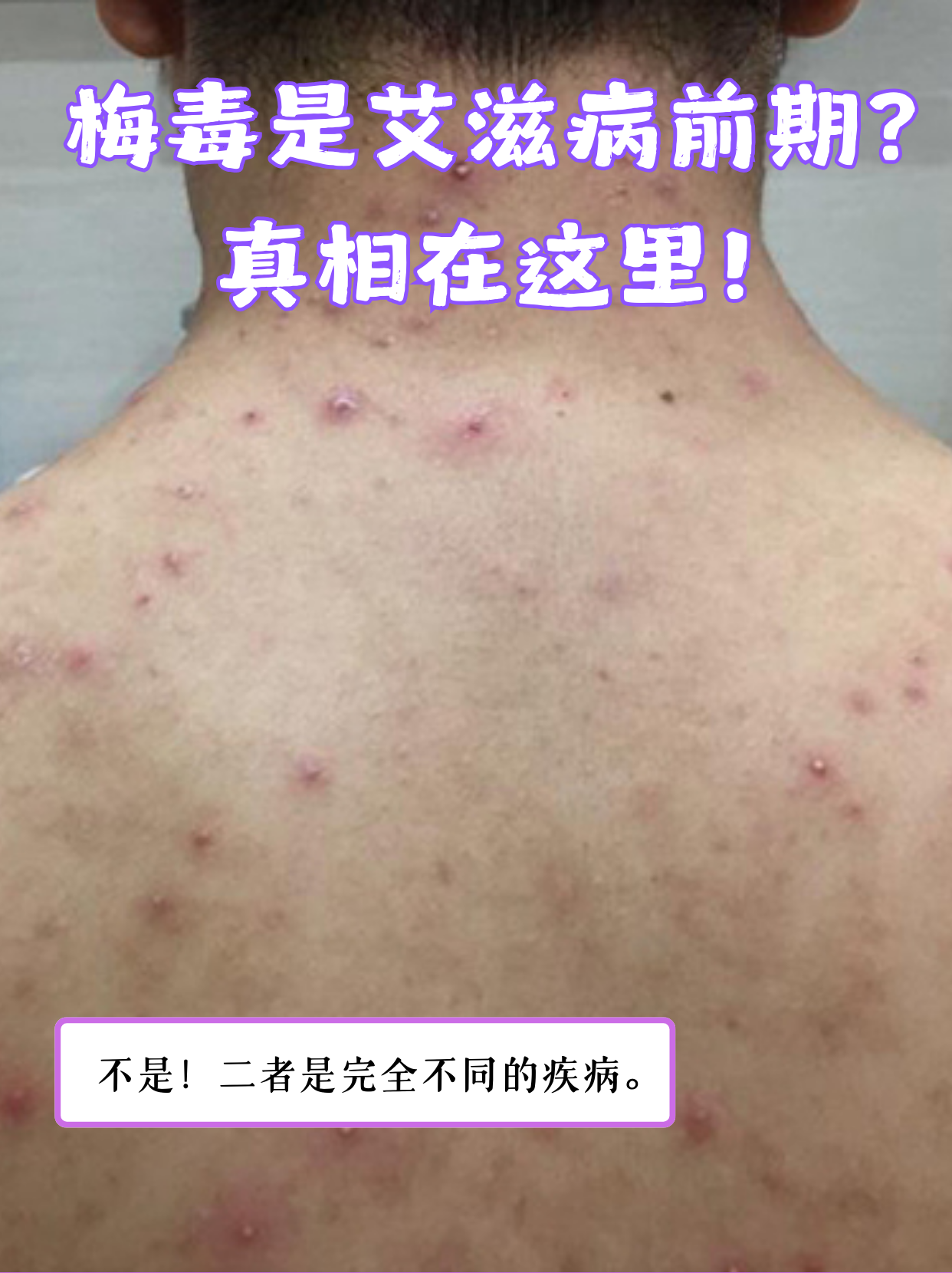 男人性病的早期症状有哪些