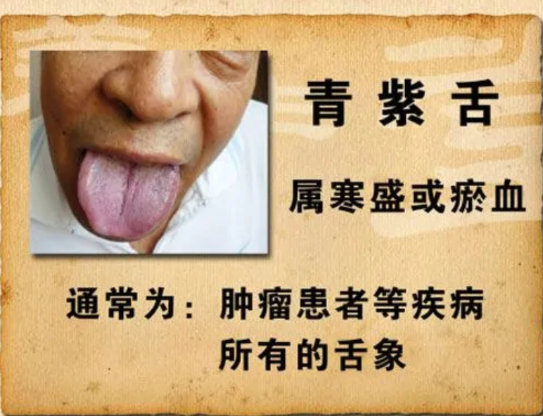 淳于嘉宝