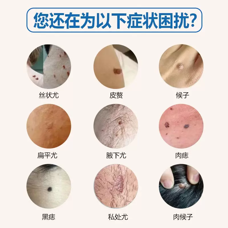 谏英媛
