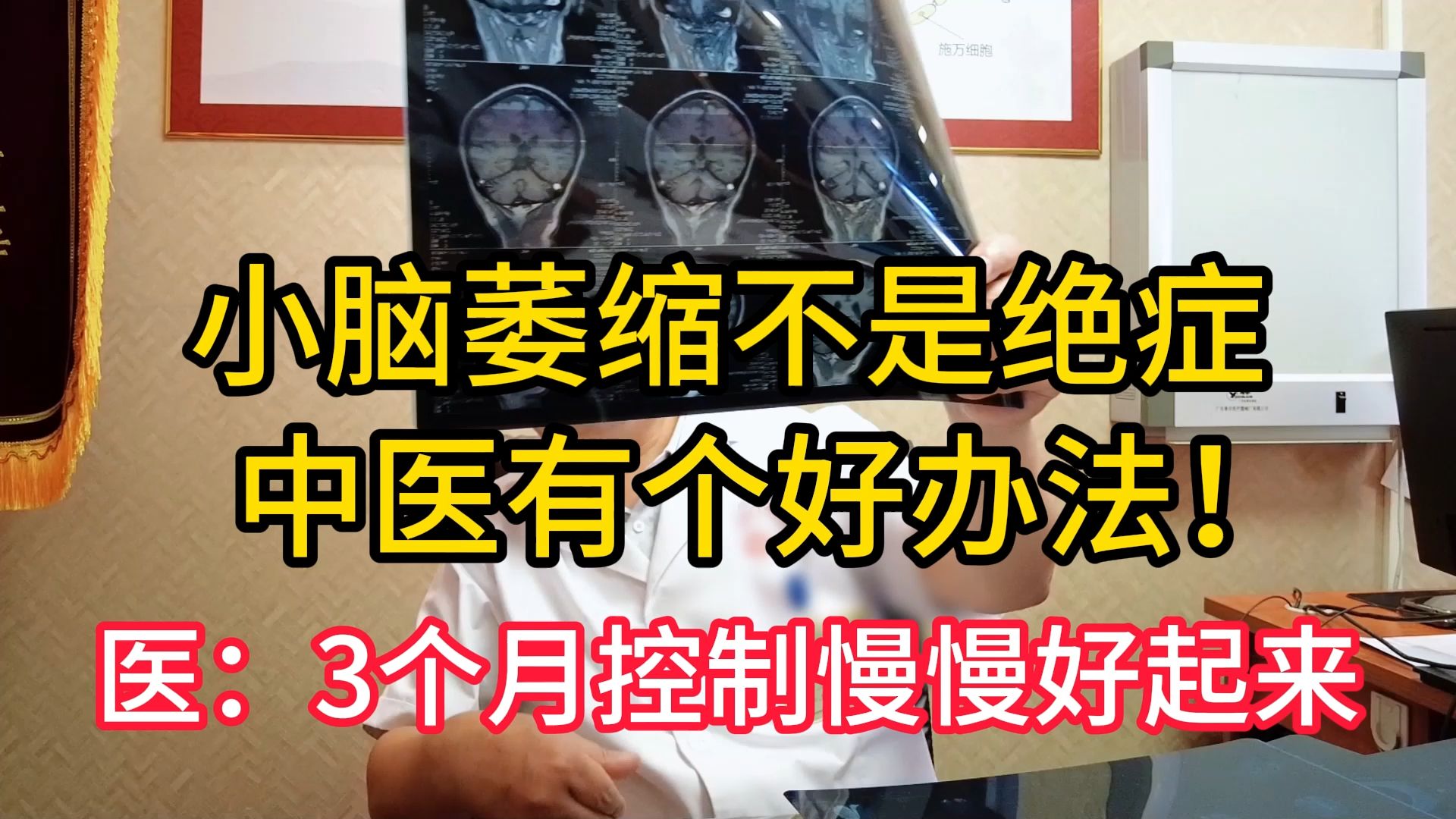 脑萎缩可以治好吗?