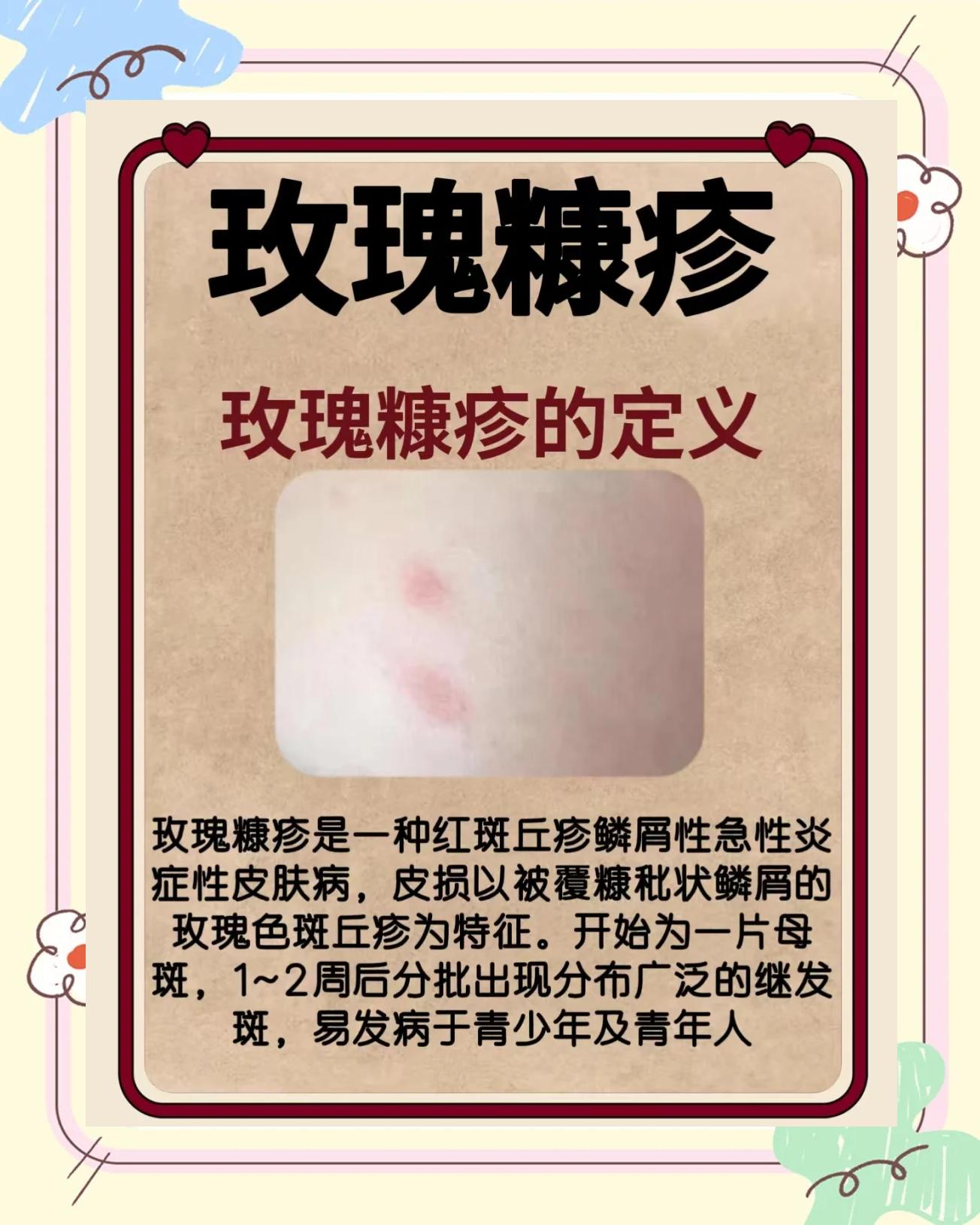 阿博简