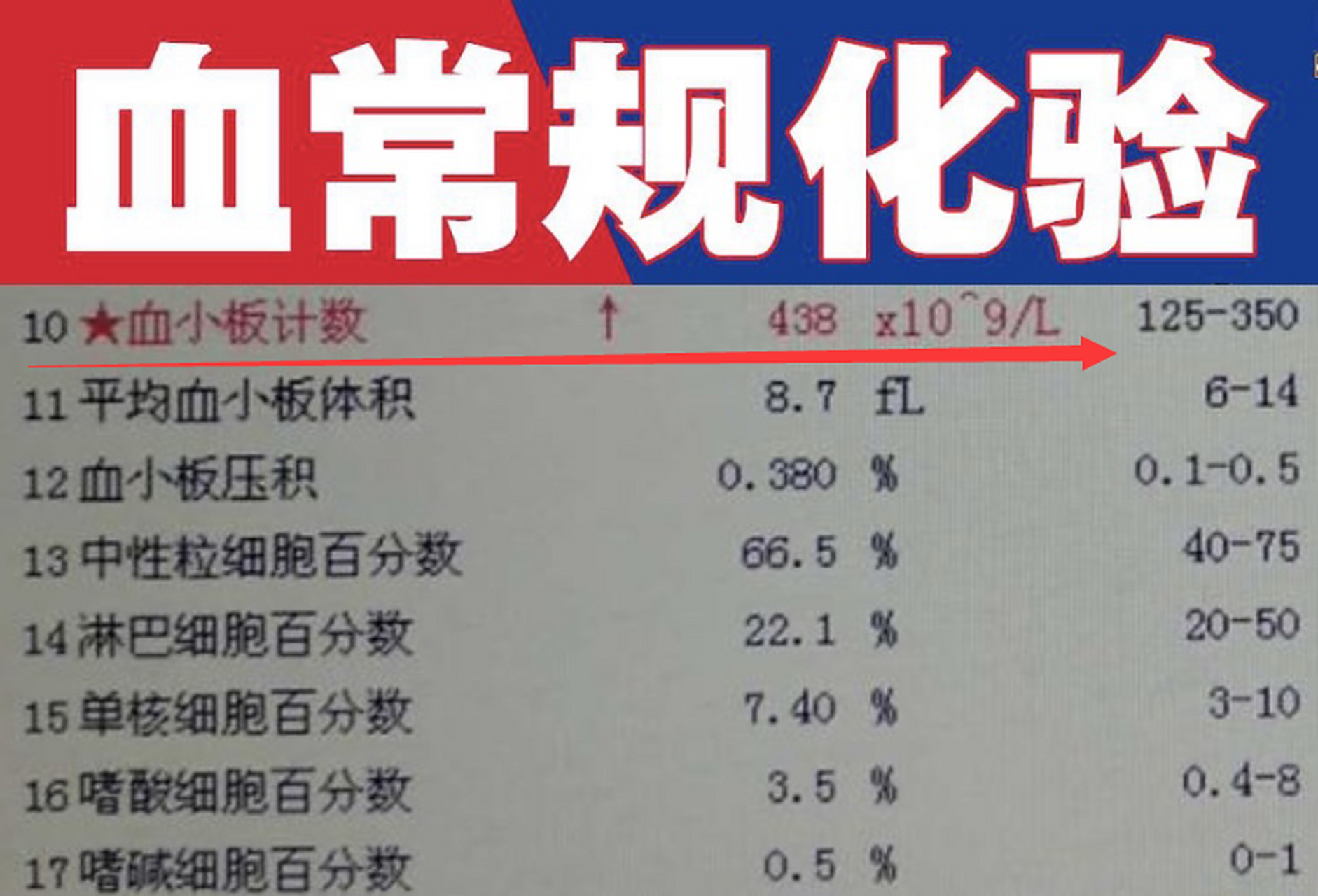 血常规血小板偏高是怎么回事