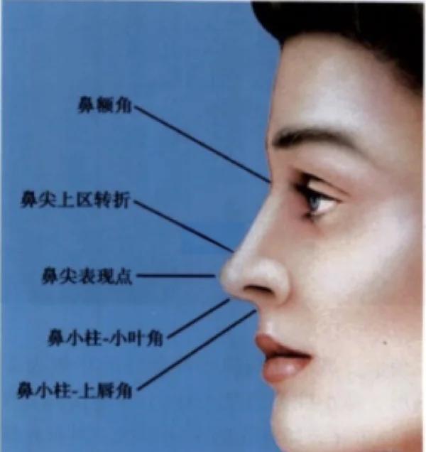 鼻头肥大鼻翼厚怎么办