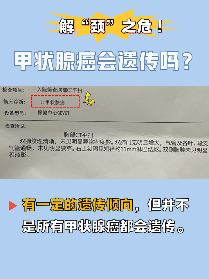 甲状腺弥漫性病变是什么意思?