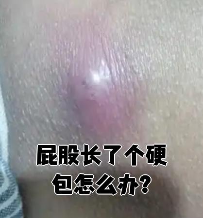 定春海