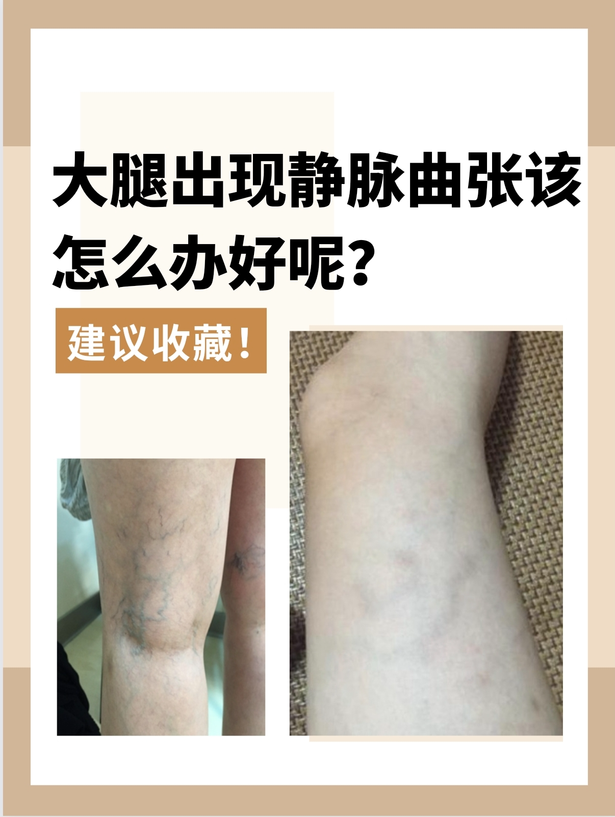 梁丘曼寒