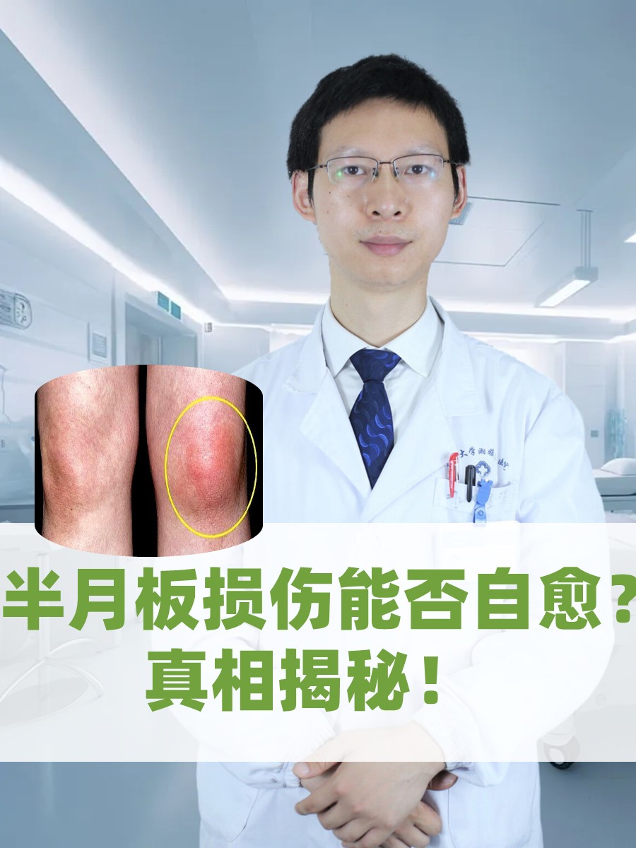 半月板损伤3度能自愈吗