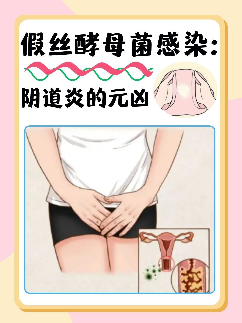 女人得性病的症状表现