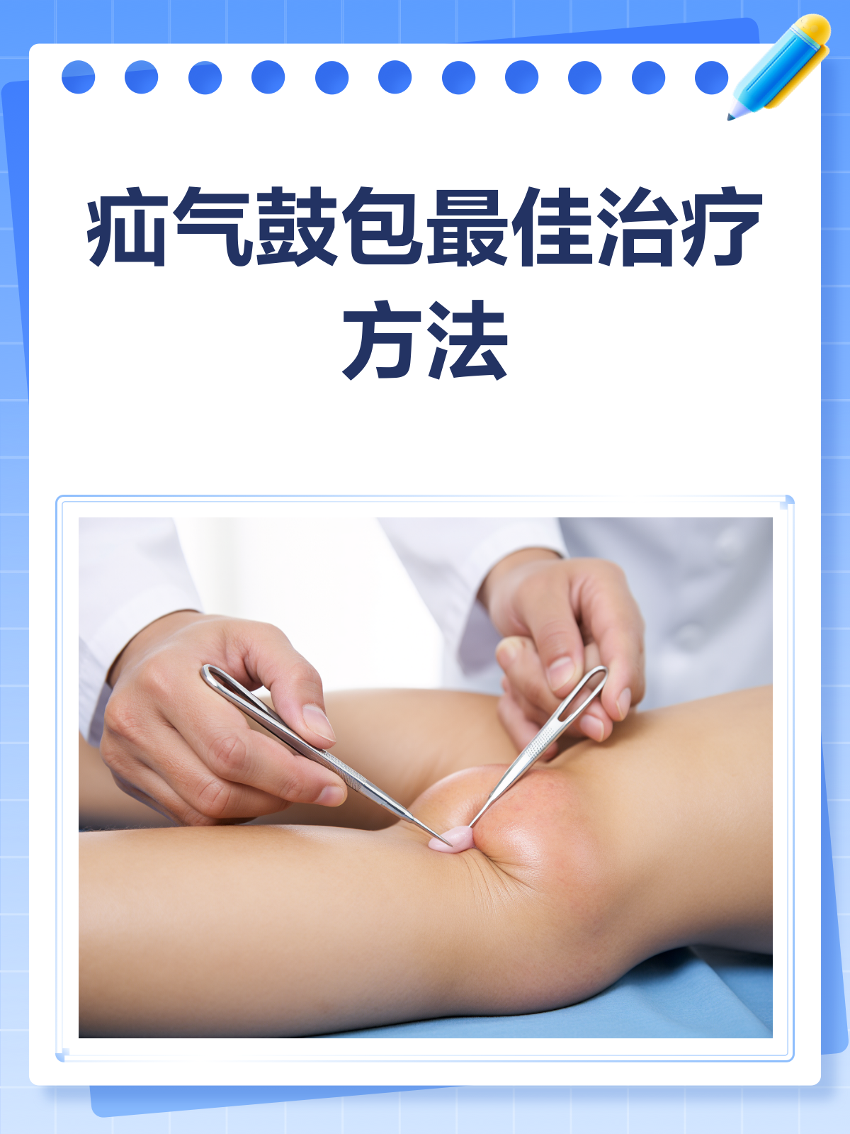 疝气,应该挂什么科？