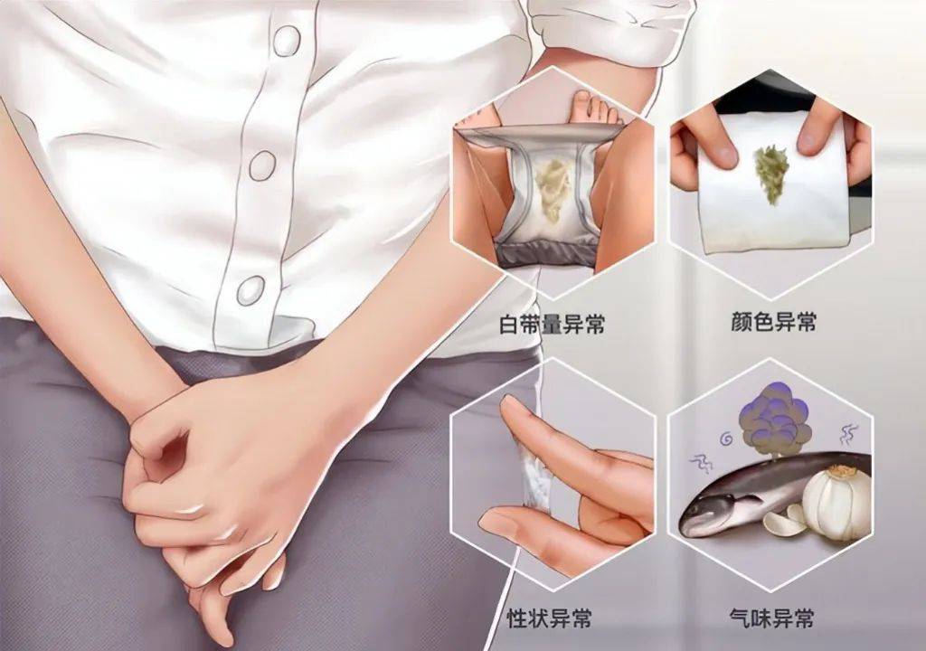 蓬拔