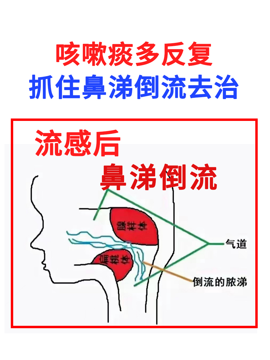 鼻涕倒流到咽喉怎么治