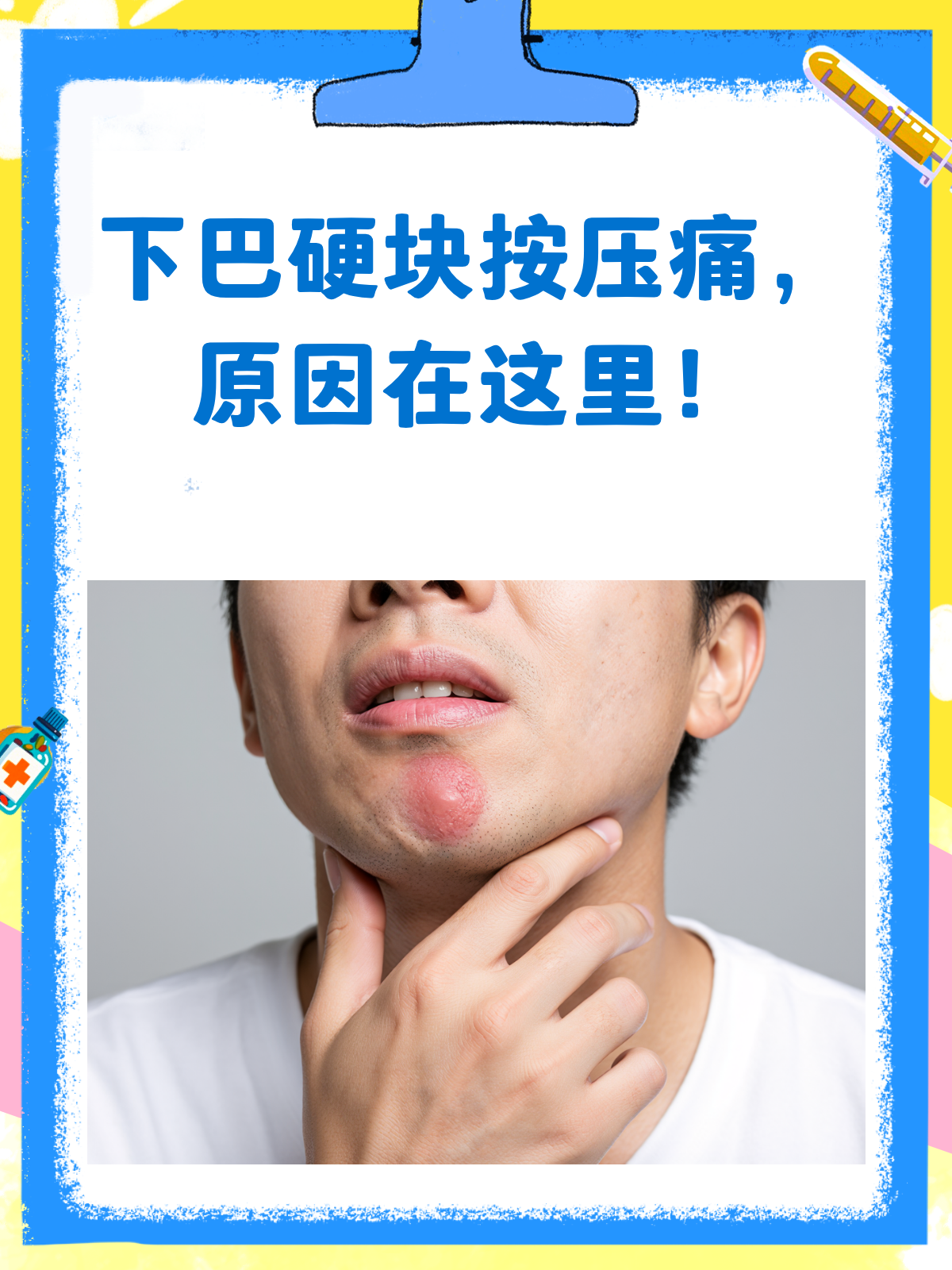 下巴肿了长了硬块按着疼!