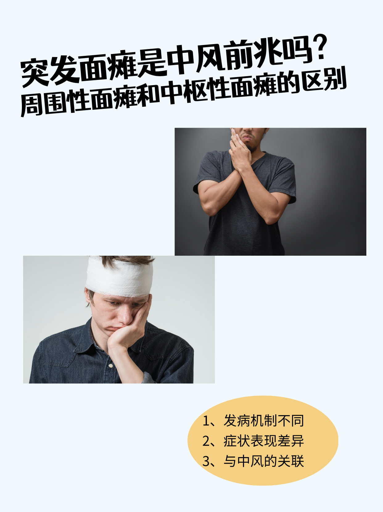 面神经麻痹是什么