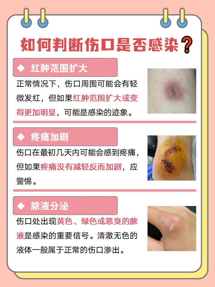 如何判断伤口是否化脓