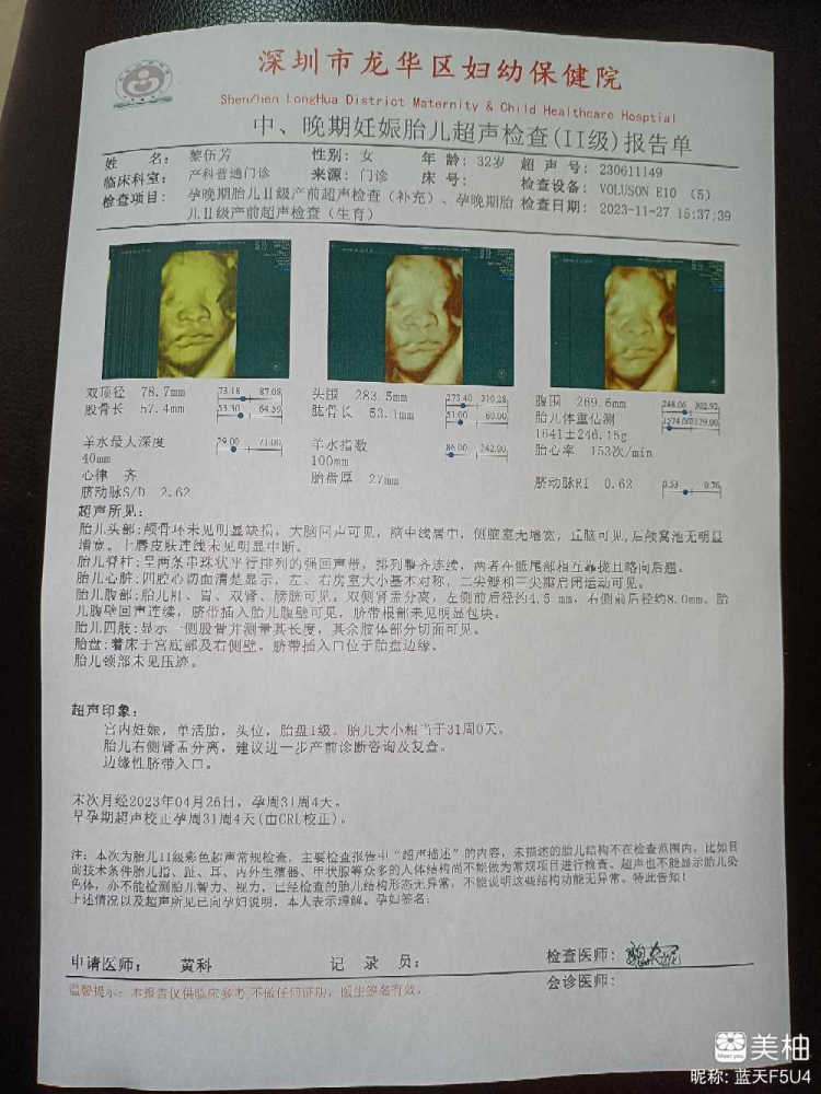 什么是肾盂分离?