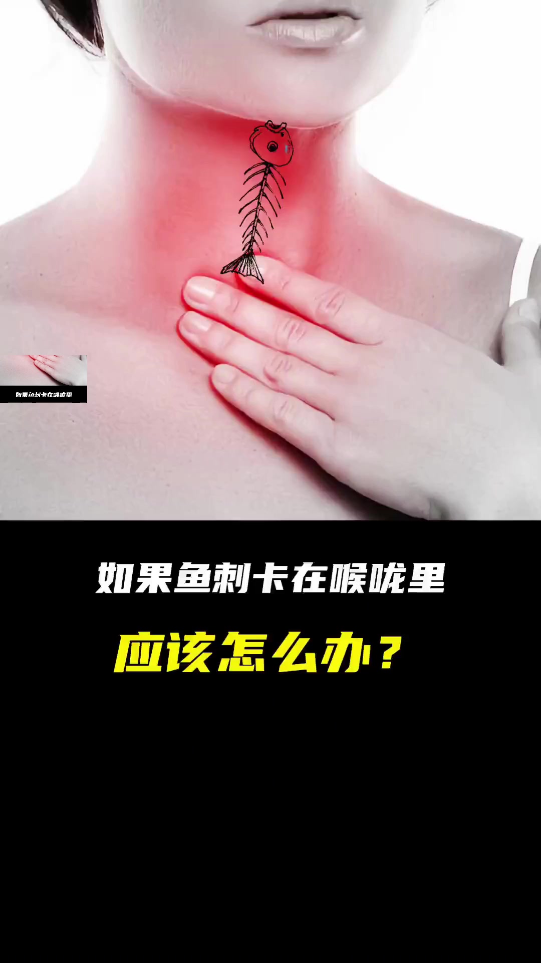 喉咙感觉卡着有东西