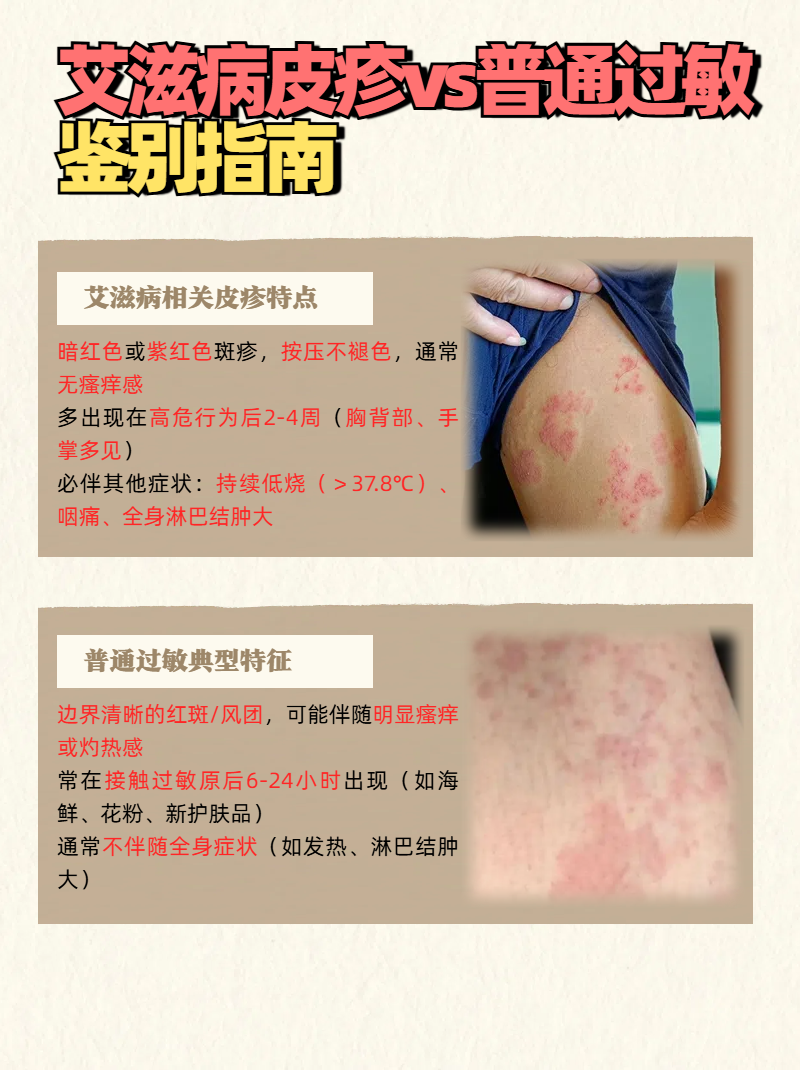 身上起红斑,怎么回事