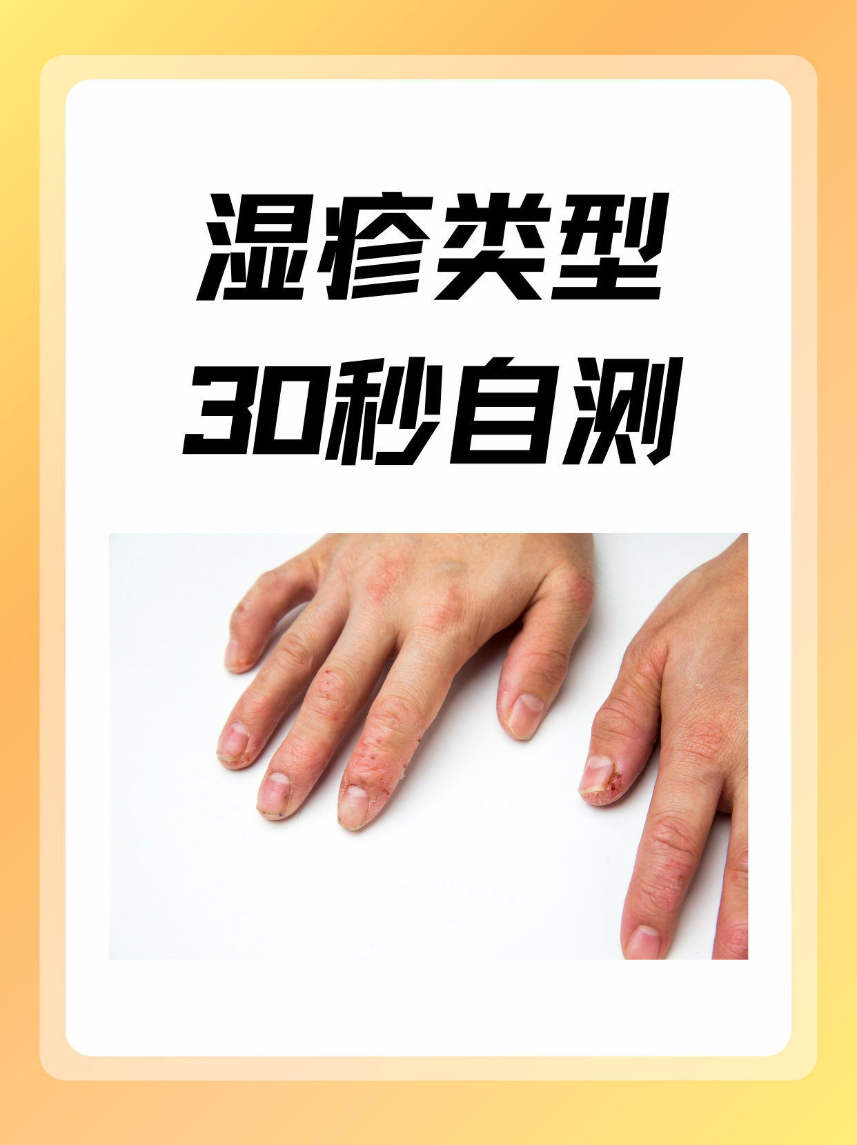 候宜