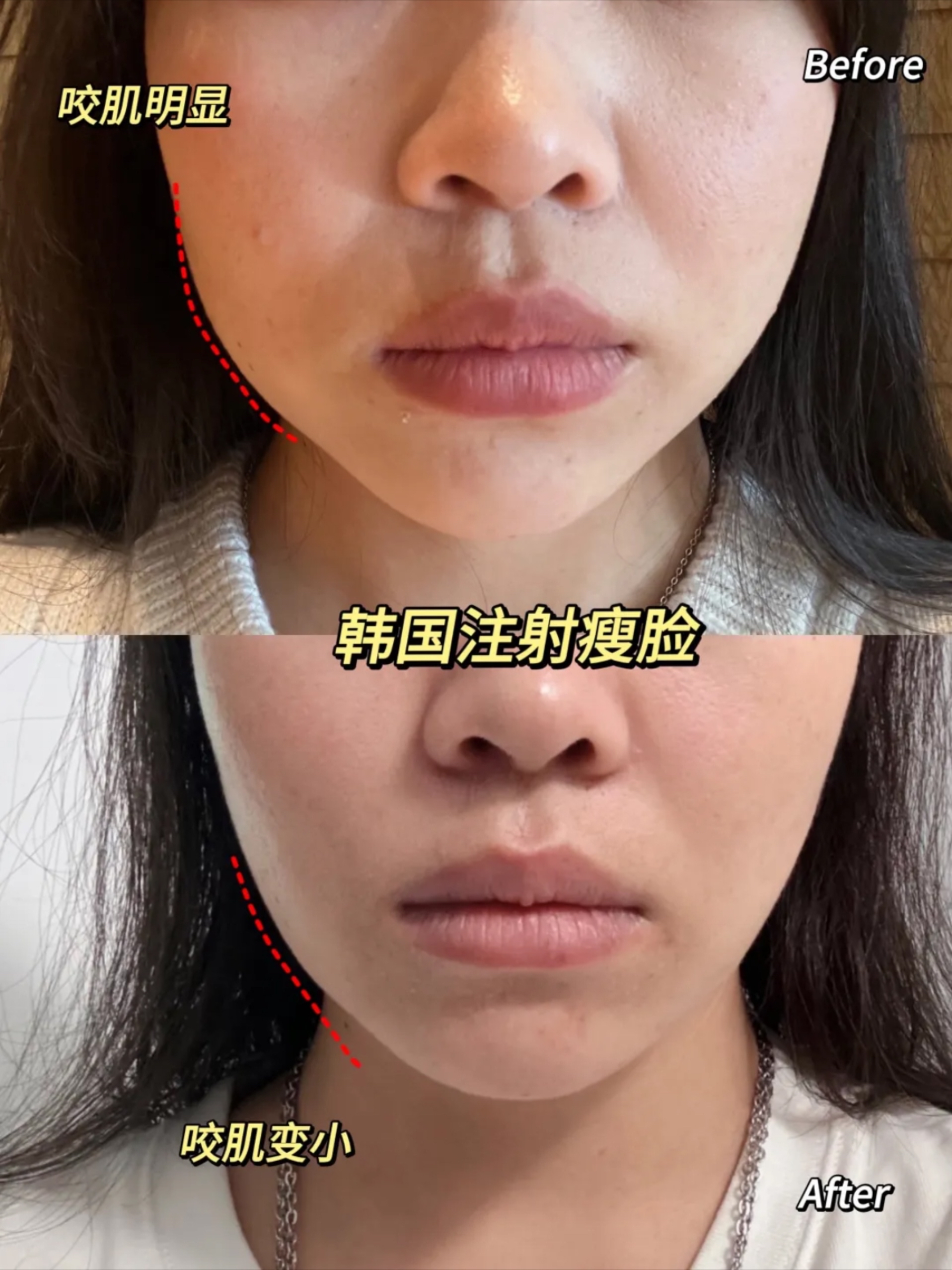 怎样使脸部变瘦